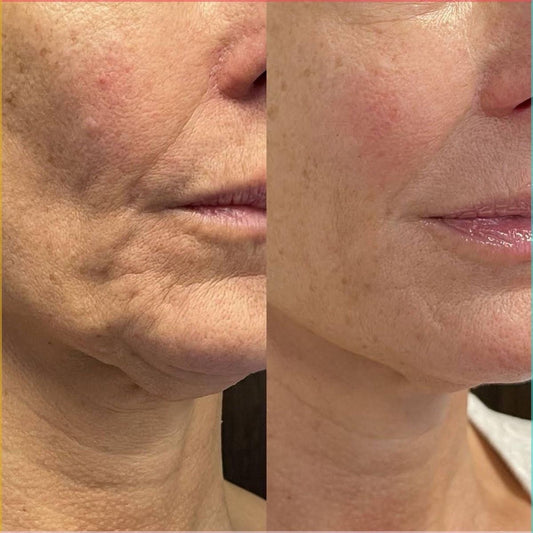 ¿Por qué es que envejecemos?