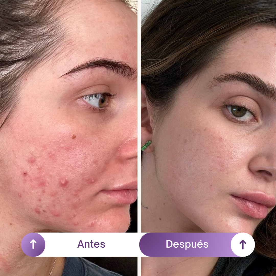 NAD1000 + Resveratrol – Rejuvenecimiento Celular