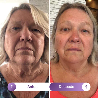 NAD1000 + Resveratrol – Rejuvenecimiento Celular